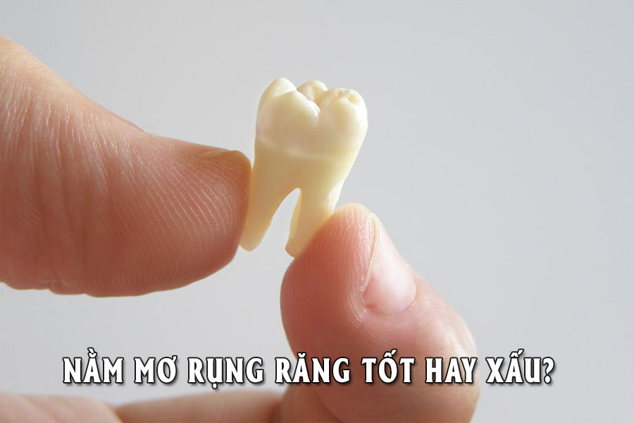 Nằm mơ bị rụng răng là tốt hay xấu ?